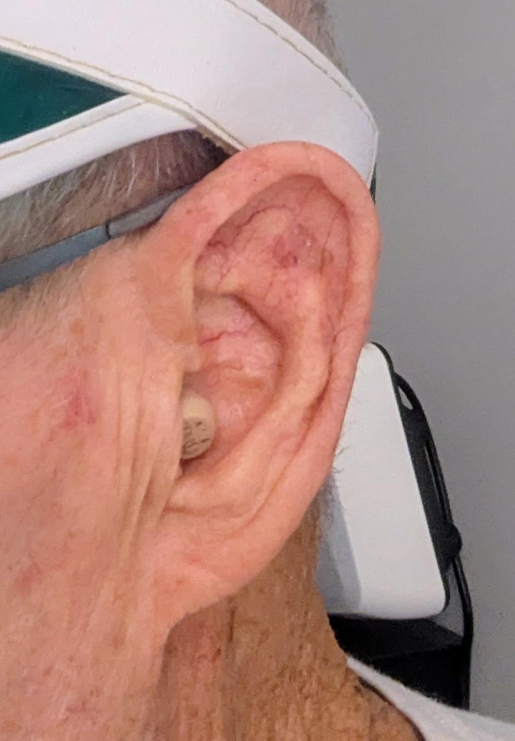 Audien Atom One OTC Hearing Aids customer photo 1